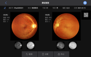 La fotografía de fondo de ojo es un examen oftalmológico básico. No sólo muestra enfermedades oculares,  sino que también puede usarse para detectar enfermedades coronarias, diabetes, hipertensión y otras  enfermedades sistémicas.  Forma del campo visual: circular